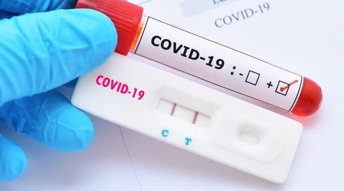 Teste rápido para Covid-19 nas farmácias.