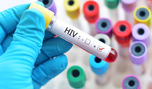 HIV