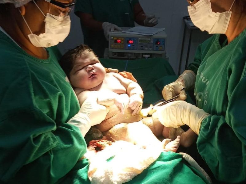 Maior bebê do Amazonas nasce em Parintins, pesa 7 quilos e mede 59 cm