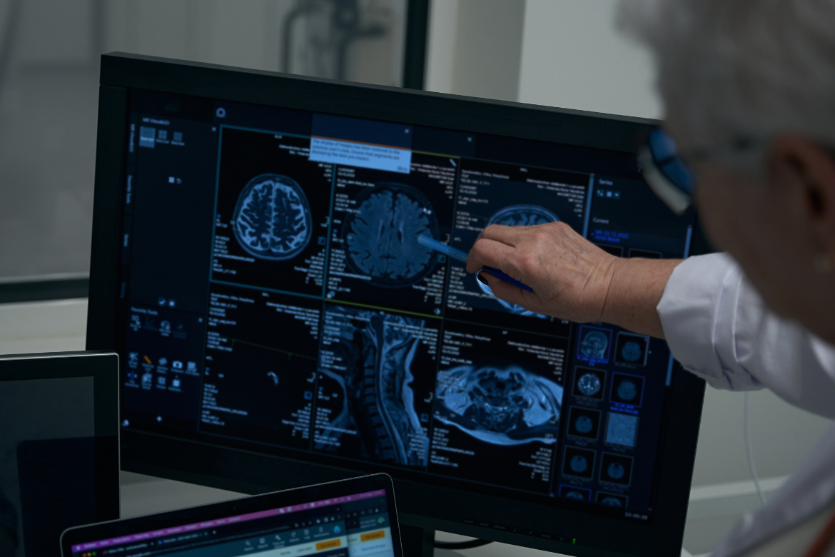 PEC é inspirada na abordagem da fundação norte-americana Neurorights, liderada pelo neurobiólogo Rafael Yusteneurotecnologia- Foto: Reprodução/Canva