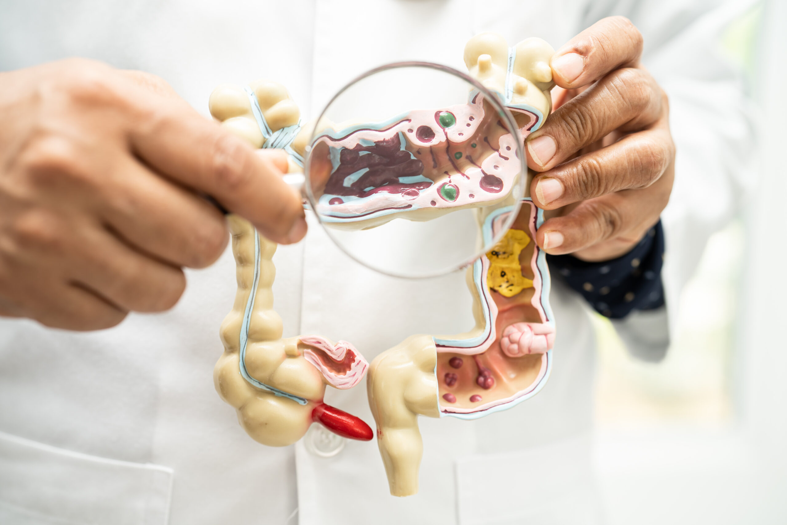 Internações por doenças intestinais crescem 61% em dez anos e fake news ...