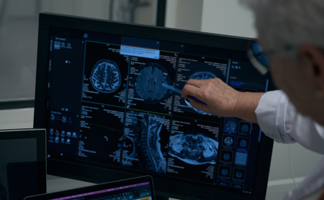 PEC é inspirada na abordagem da fundação norte-americana Neurorights, liderada pelo neurobiólogo Rafael Yusteneurotecnologia- Foto: Reprodução/Canva