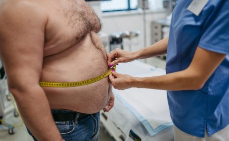 Relatório global alerta para o avanço da obesidade, que pode atingir 70% dos brasileiros até 2035, impactando a saúde pública e a economia.