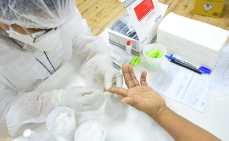 hiv e sifilis